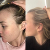 HairRejuve™ Elektrische Massagekam | Stimuleert je haarzakjes voor betere haargroei